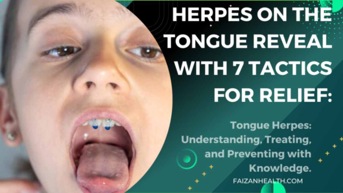 herpes on tongue