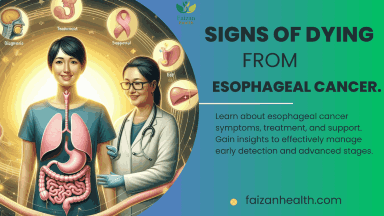 Esophageal Cancer.