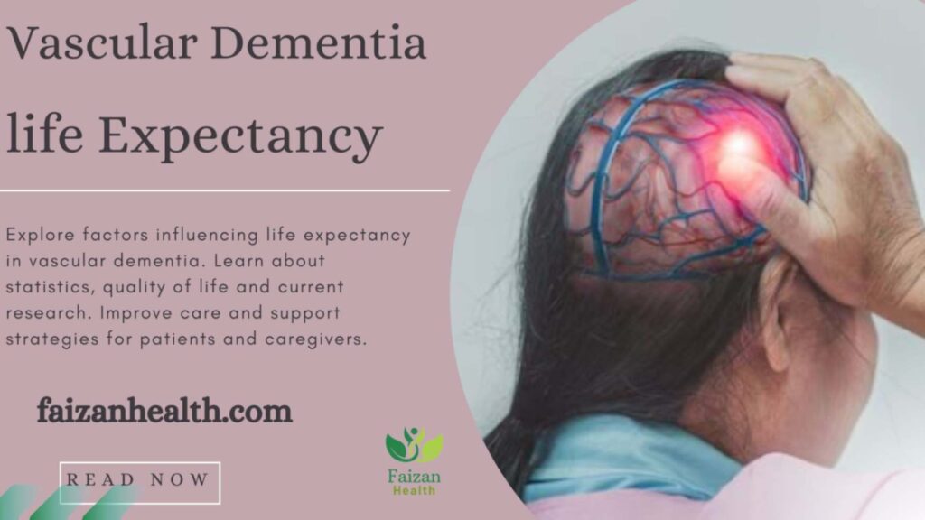 Vascular Dementia life Expectancy.