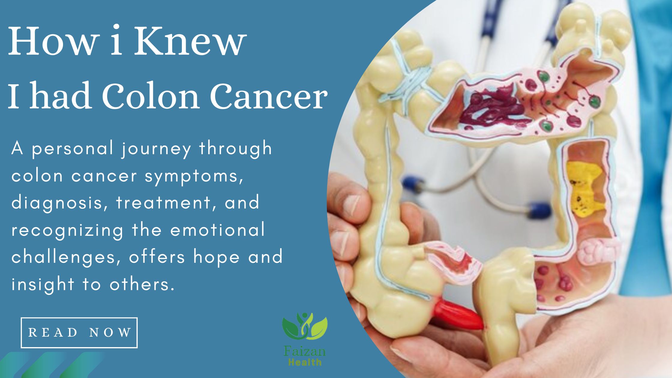 How i Knew I had Colon Cancer